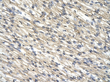 CNP Rabbit Polyclonal Antibody