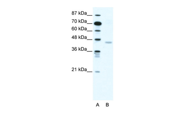 CNP Rabbit Polyclonal Antibody