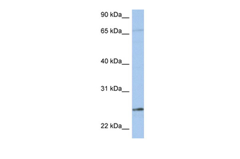 KLK6 Rabbit Polyclonal Antibody