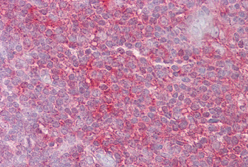 KIF2A Rabbit Polyclonal Antibody