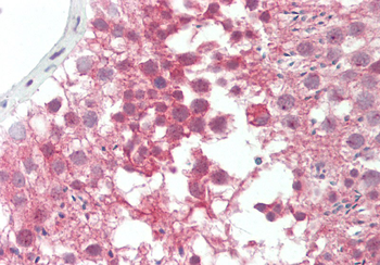 BRD4 Rabbit Polyclonal Antibody