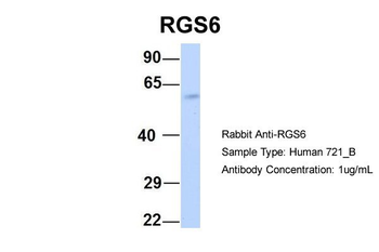 RGS6 Rabbit Polyclonal Antibody