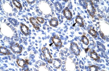 RGS6 Rabbit Polyclonal Antibody