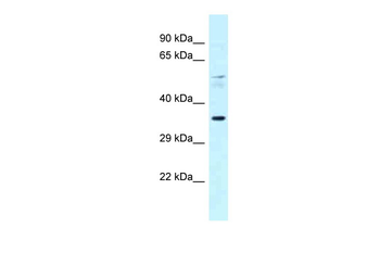 Ppara Rabbit Polyclonal Antibody