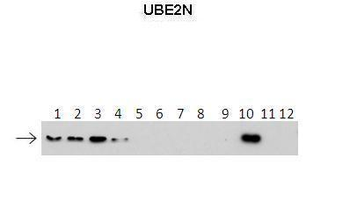 UBE2N Rabbit Polyclonal Antibody
