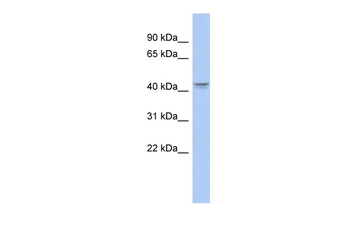 PTGER3 Rabbit Polyclonal Antibody