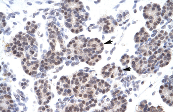 XRCC5 Rabbit Polyclonal Antibody
