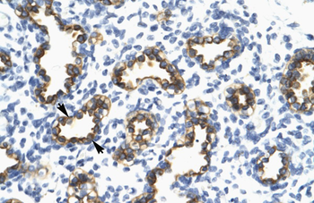 RFP2 Rabbit Polyclonal Antibody