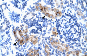 ATF2 Rabbit Polyclonal Antibody