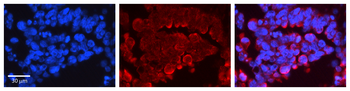 ATF2 Rabbit Polyclonal Antibody