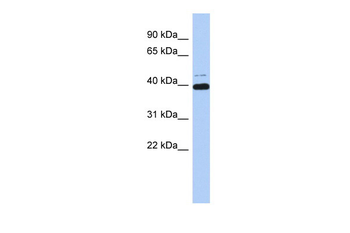 MAZ Rabbit Polyclonal Antibody