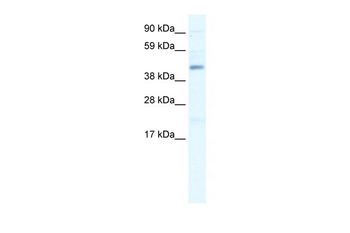 SMARCB1 Rabbit Polyclonal Antibody