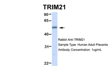 TRIM21 Rabbit Polyclonal Antibody