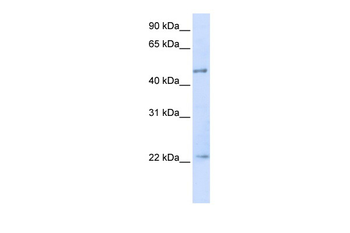 TRIM21 Rabbit Polyclonal Antibody