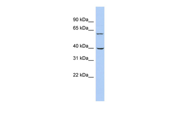 TRIM26 Rabbit Polyclonal Antibody