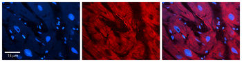 ASPH Rabbit Polyclonal Antibody