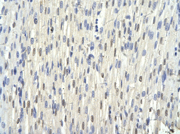 ASH2L Rabbit Polyclonal Antibody