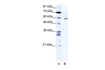 PDLIM5 Rabbit Polyclonal Antibody