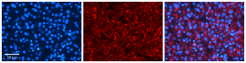 PDLIM5 Rabbit Polyclonal Antibody
