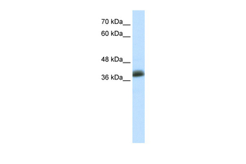 SAP30BP Rabbit Polyclonal Antibody