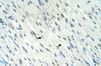 SERTAD1 Rabbit Polyclonal Antibody