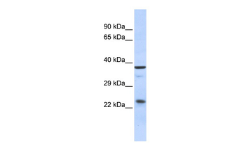 SERTAD1 Rabbit Polyclonal Antibody