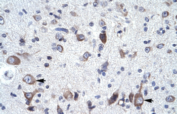 FREQ Rabbit Polyclonal Antibody