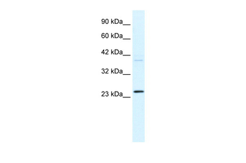 FREQ Rabbit Polyclonal Antibody