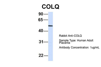 COLQ Rabbit Polyclonal Antibody