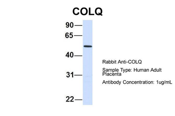 COLQ Rabbit Polyclonal Antibody