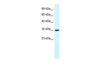 COLQ Rabbit Polyclonal Antibody