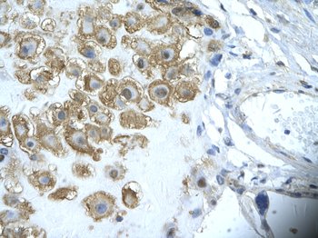 ENO1 Rabbit Polyclonal Antibody