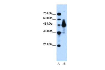 ENO1 Rabbit Polyclonal Antibody