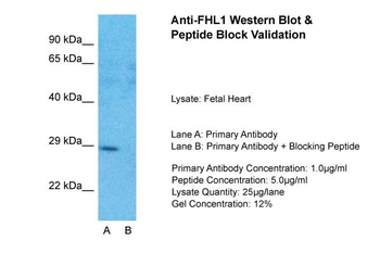 FHL1 Rabbit Polyclonal Antibody