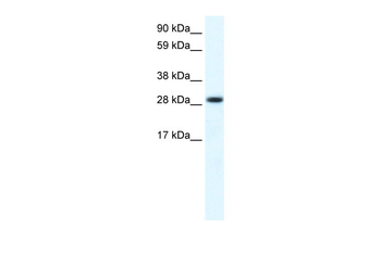 FHL1 Rabbit Polyclonal Antibody