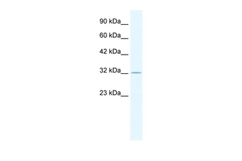 ZFP36 Rabbit Polyclonal Antibody