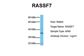 RASSF7 Rabbit Polyclonal Antibody