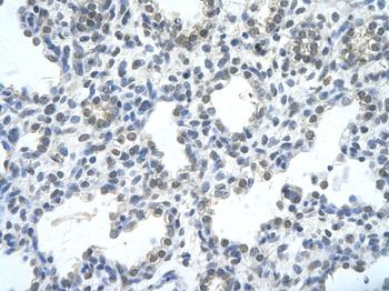 RASSF7 Rabbit Polyclonal Antibody