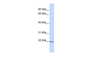 ZFAND5 Rabbit Polyclonal Antibody