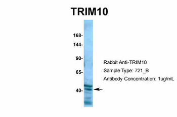 TRIM10 Rabbit Polyclonal Antibody
