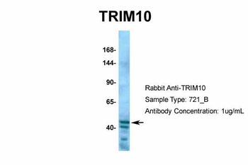 TRIM10 Rabbit Polyclonal Antibody