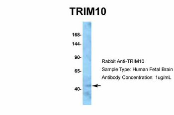 TRIM10 Rabbit Polyclonal Antibody