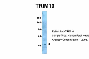 TRIM10 Rabbit Polyclonal Antibody
