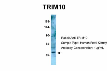 TRIM10 Rabbit Polyclonal Antibody