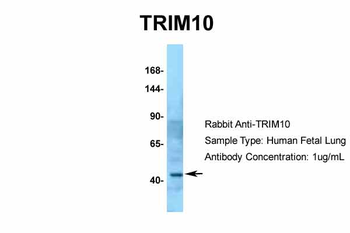 TRIM10 Rabbit Polyclonal Antibody