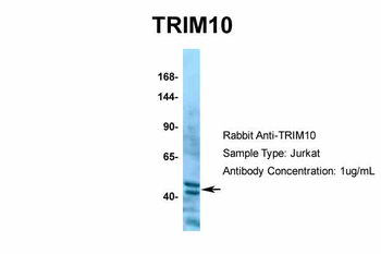 TRIM10 Rabbit Polyclonal Antibody