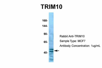 TRIM10 Rabbit Polyclonal Antibody