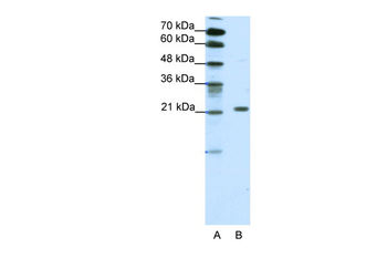 CBX1 Rabbit Polyclonal Antibody