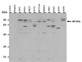 BRD3 Rabbit Polyclonal Antibody