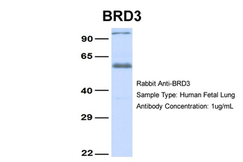 BRD3 Rabbit Polyclonal Antibody